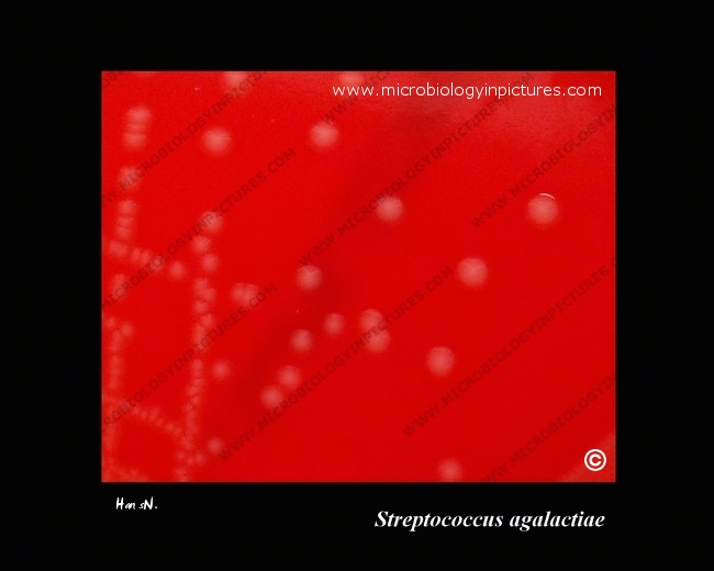 streptococcus agalactiae, weak beta-hemolysis